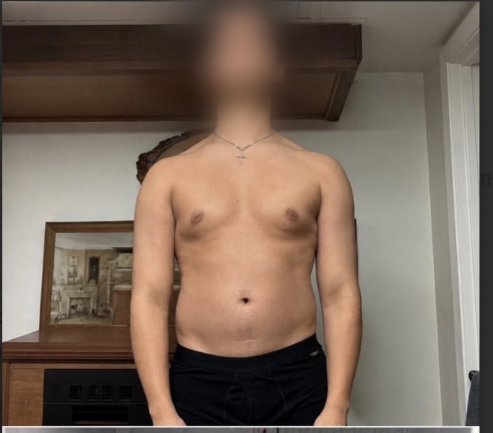 Zay's before photo showing his starting physique, face blurred for privacy